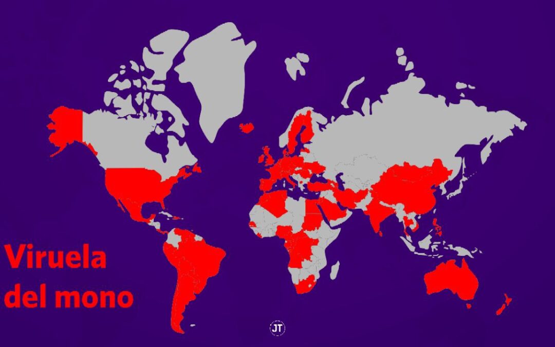 AVANZAN LOS CASOS DE VIRUELA DEL MONO EN ARGENTINA